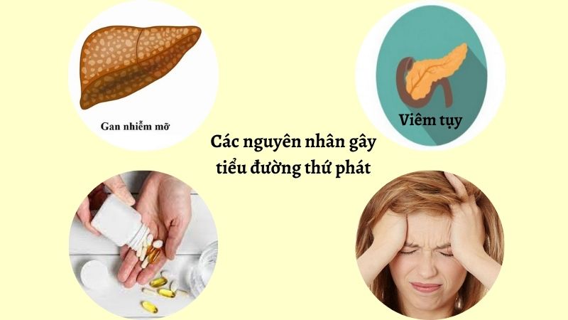 Nguyên nhân gây đái tháo đường thứ phát