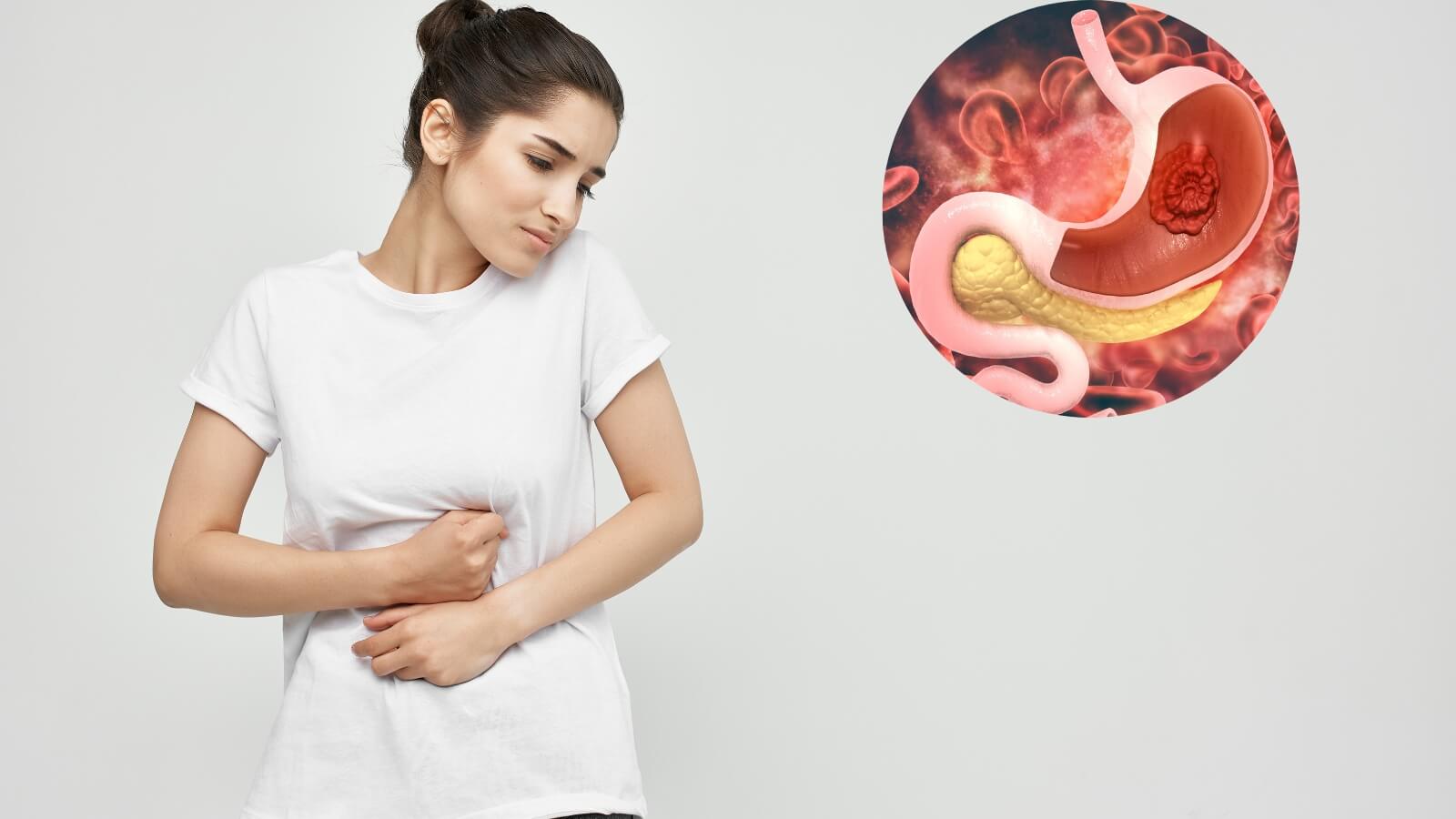 Đau vùng thượng vị là triệu chứng đau dạ dày phổ biến nhất