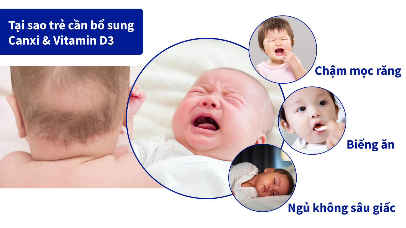 Canxi và Vitamin D3 có vai trò quan trọng cho sự phát triển của trẻ