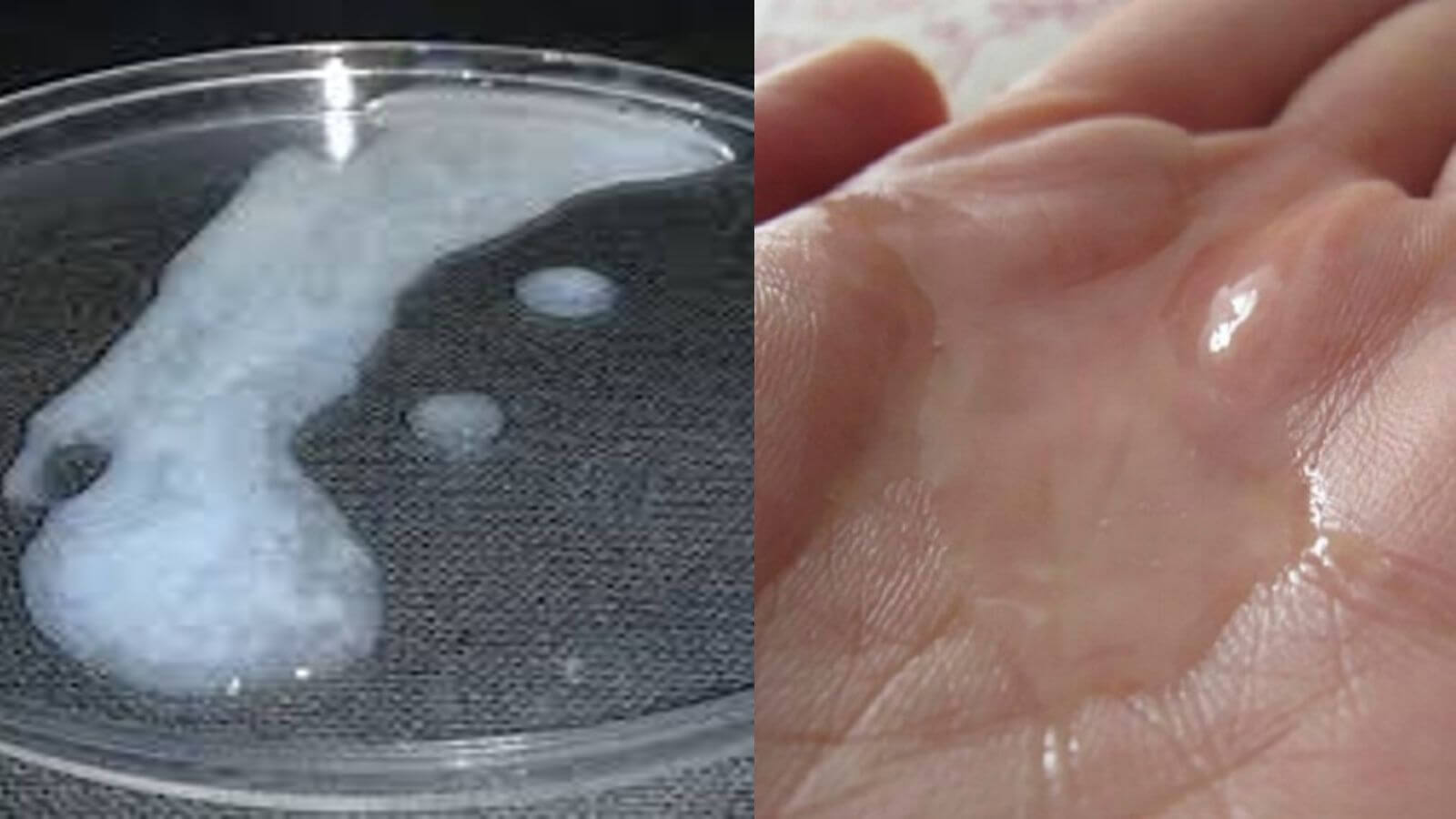 Độ đặc hay loãng của tinh dịch cũng cảnh bảo nam giới đang có nguy cơ gặp vấn đề sức khỏe sinh sản