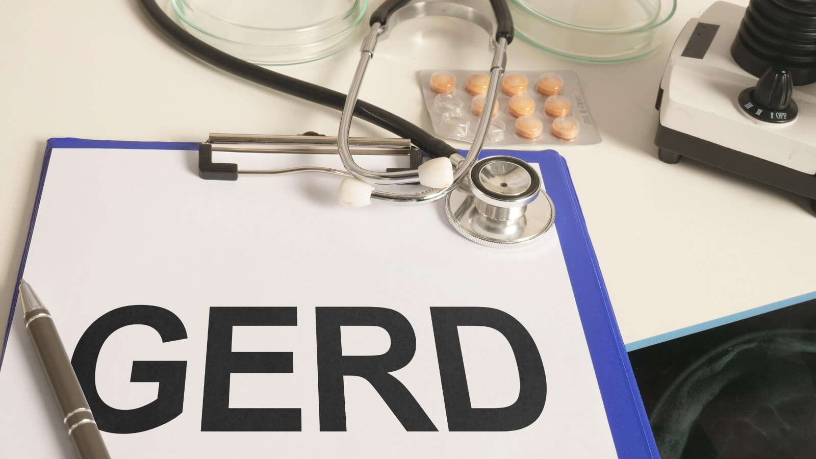 Đau dạ dày buồn nôn là một trong những triệu chứng của trào ngược dạ dày thực quản