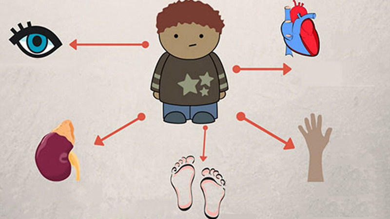 Tiểu đường tuýp 1 có thể dẫn đến nhiều biến chứng nguy hiểm