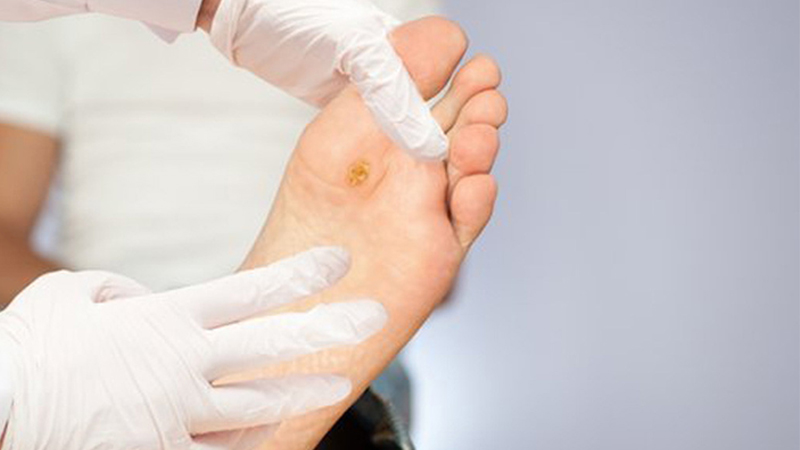 Nhiễm trùng khi bị tiểu đường