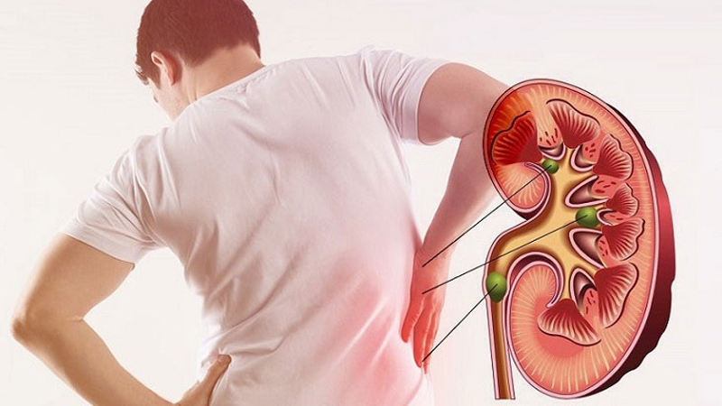 Biến chứng thận ở bệnh nhân tiểu đường