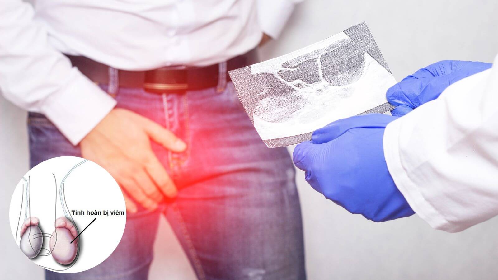 Những dấu hiệu vô sinh ở tuổi dậy thì nam có thể đến từ bệnh lý từng mắc phải