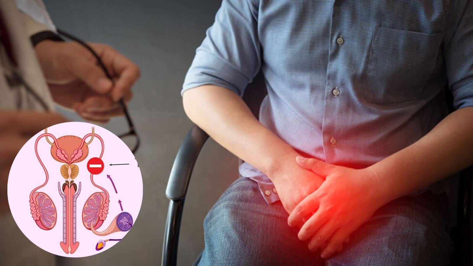 Một trong những nguyên nhân gây tinh trùng vón cục là tắc nghẽn ống dẫn tinh