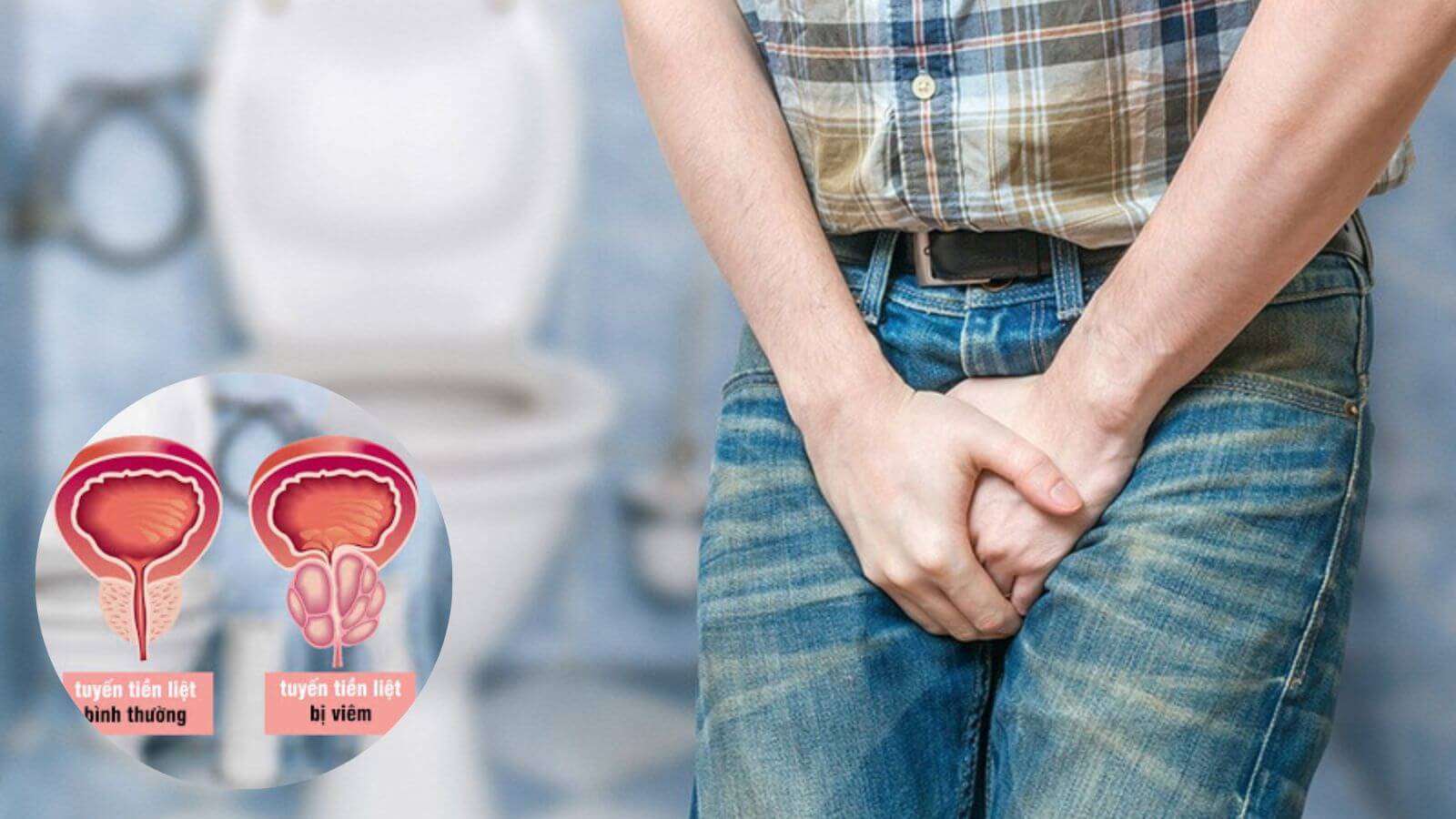 Tuyến tiền liệt bị viêm có thể do nhiễm vi khuẩn hoặc không