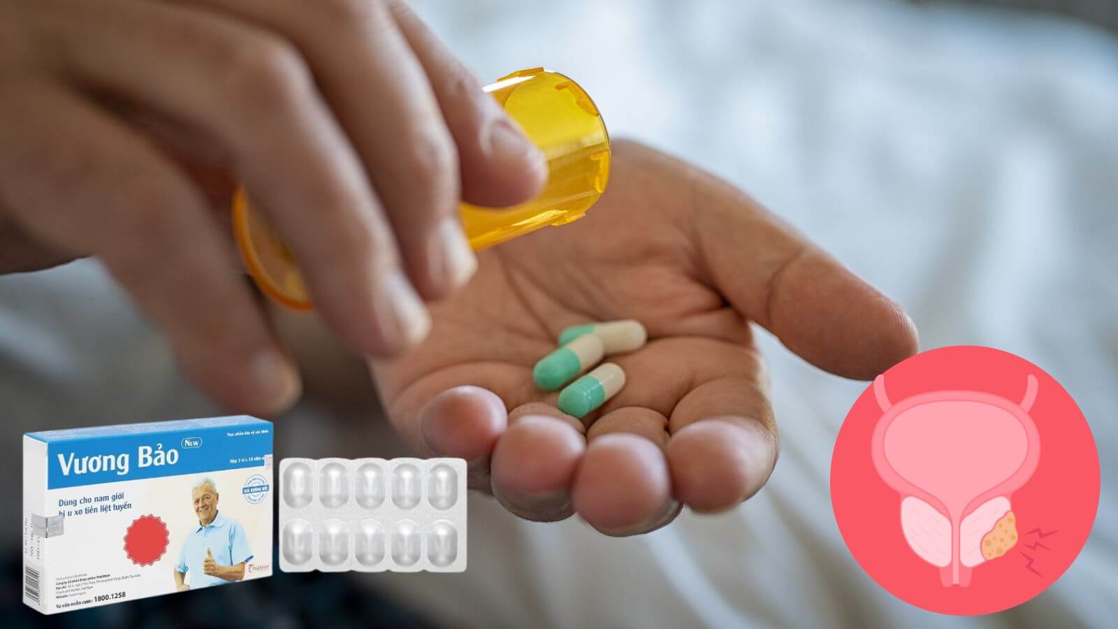 Vuong Bảo - thuốc hỗ trợ giảm viêm tuyến tiền liệt, phì đại tuyền tiền liệt