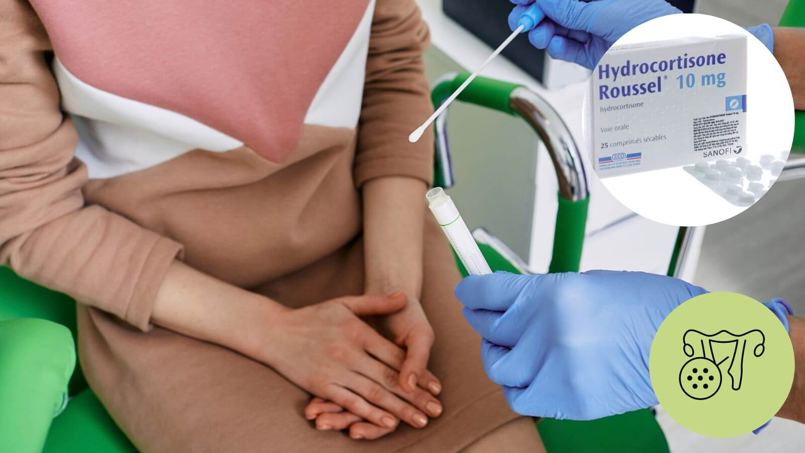 Lạm dụng thuốc chống viêm làm tăng nguy cơ viêm nhiễm phụ khoa