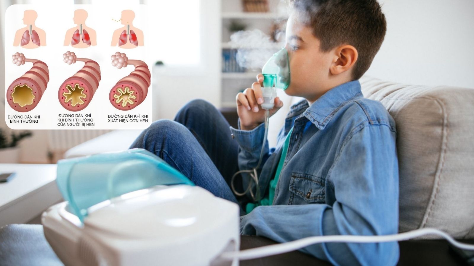 Có nên sử dụng máy khí dung cho người hen không? Lưu ý khi sử dụng