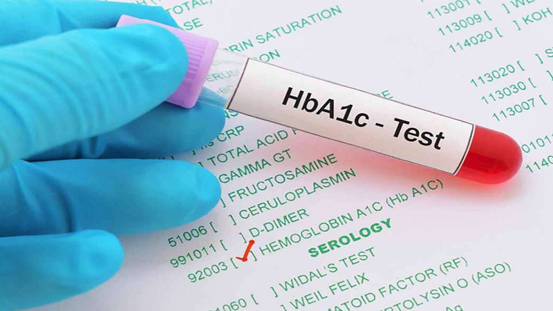Cần thực hiện xét nghiệm HbA1c để chẩn đoán tiểu đường tuýp 2