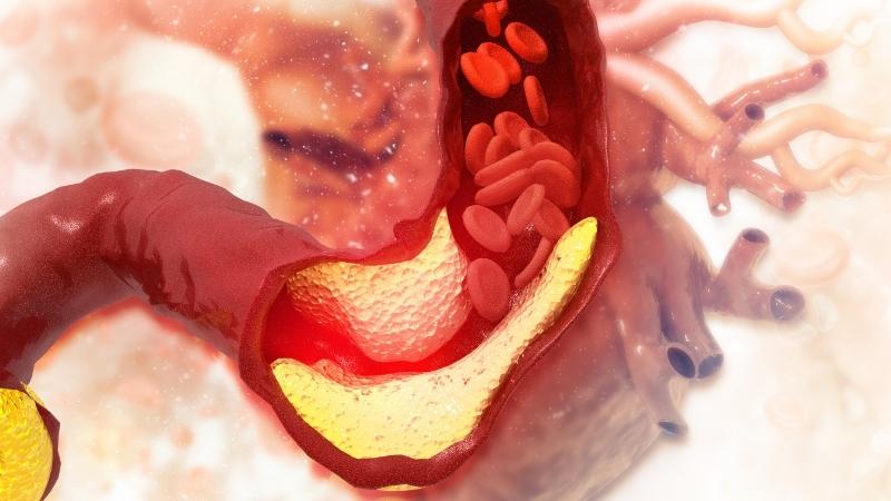 Dây thìa canh lá to có khả năng đẩy lùi bệnh mỡ máu