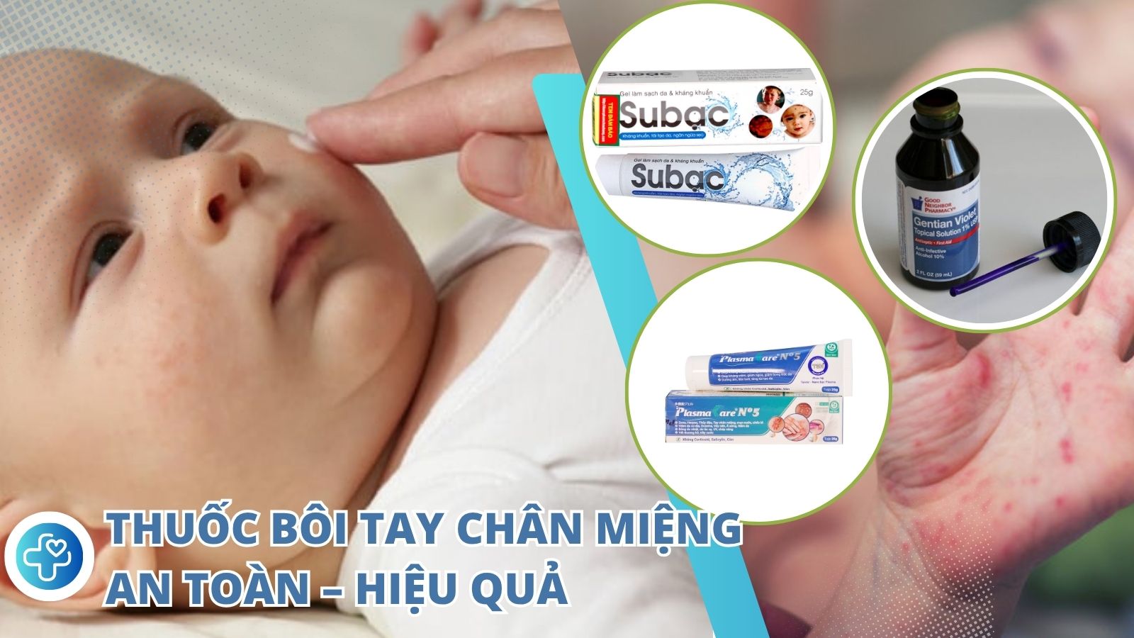 Điểm danh top 8 thuốc bôi tay chân miệng an toàn và hiệu quả