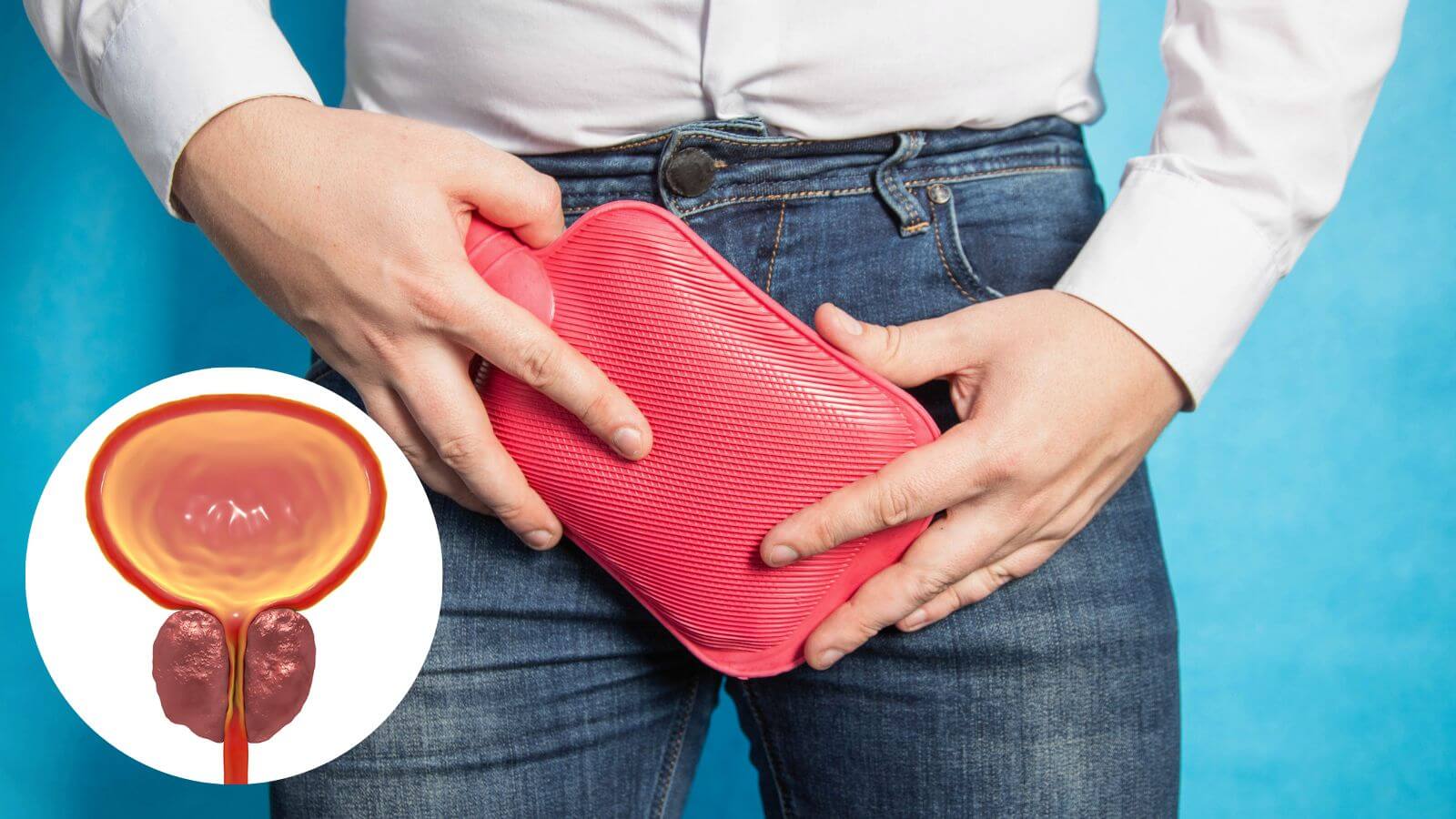 Phì đại tuyến tiền liệt thường gặp ở độ tuổi trung niên trở lên