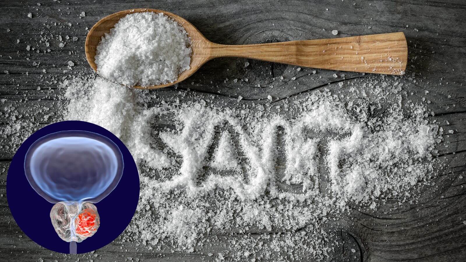 Hạn chế muối trong thực đơn của người phì đại tuyến tiền liệt