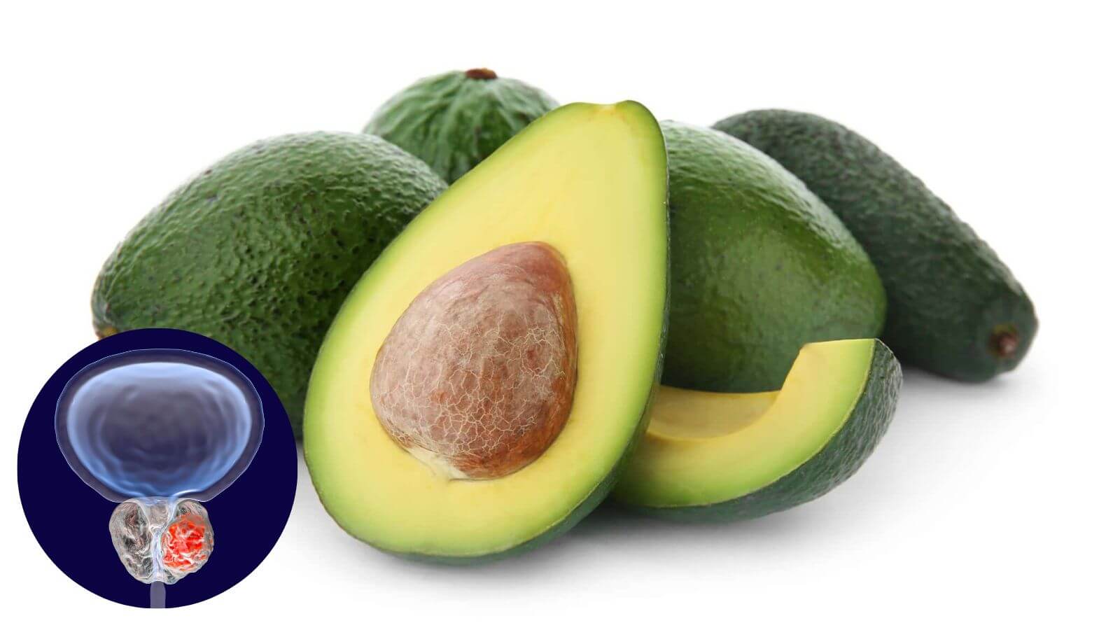 Nên bổ sung bơ thường xuyên để cải thiện sức khỏe