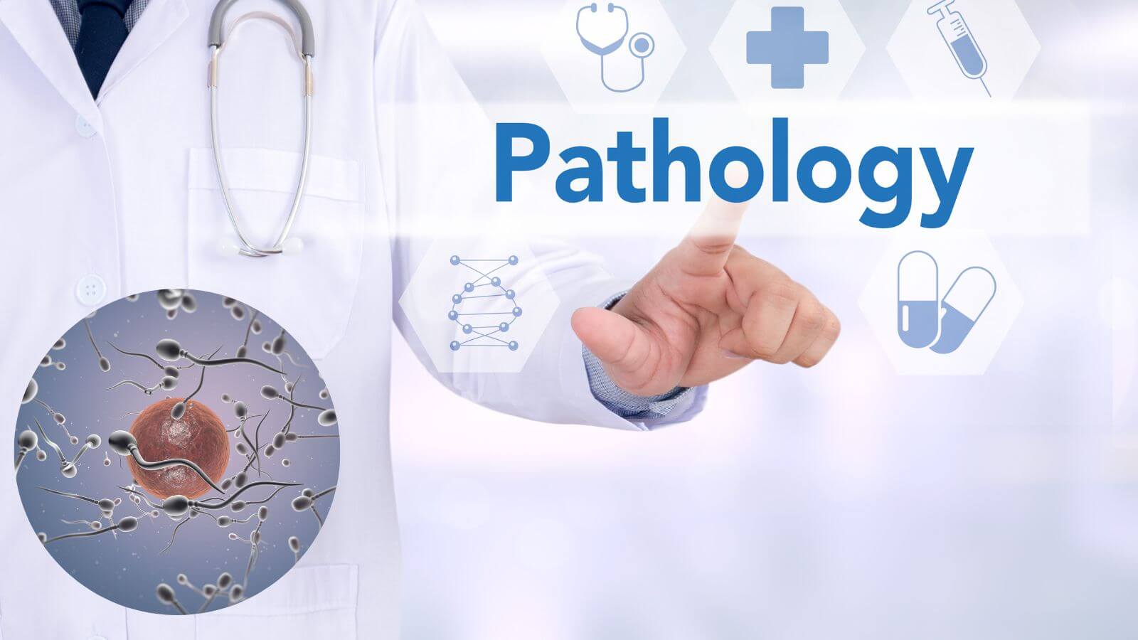 Bệnh lý làm giảm cả số lượng và chất lượng tinh trùng