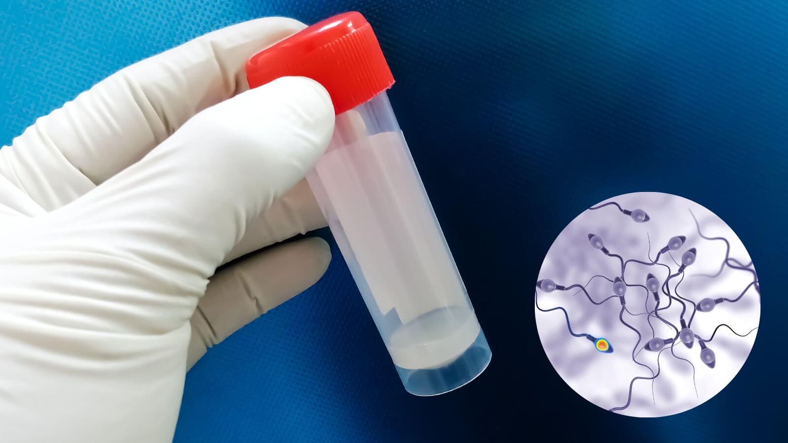 Kết quả xét nghiệm giúp đánh giá được các vấn đề ảnh hưởng tới chức năng sinh sản của nam giới