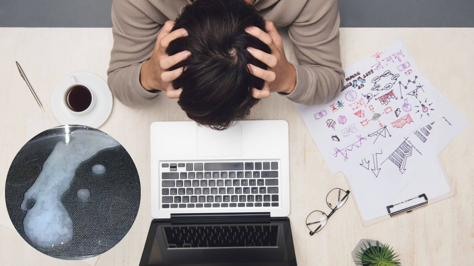 Stress, căng thẳng có thể khiến tinh trùng vón cục