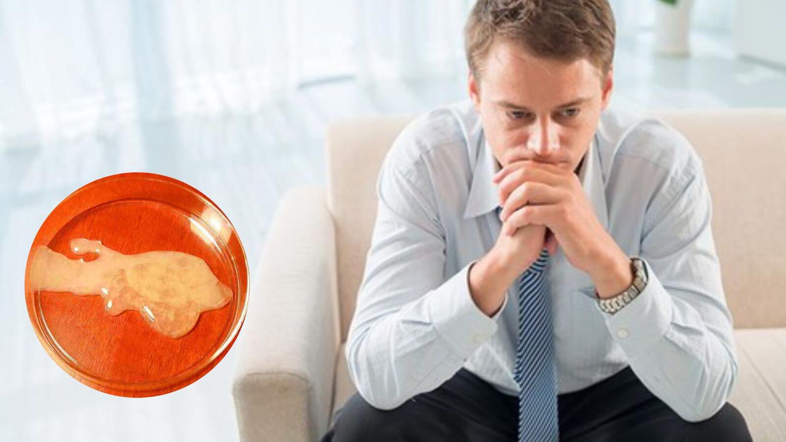 Giải đáp “Tinh trùng vón cục như thạch có con được không”
