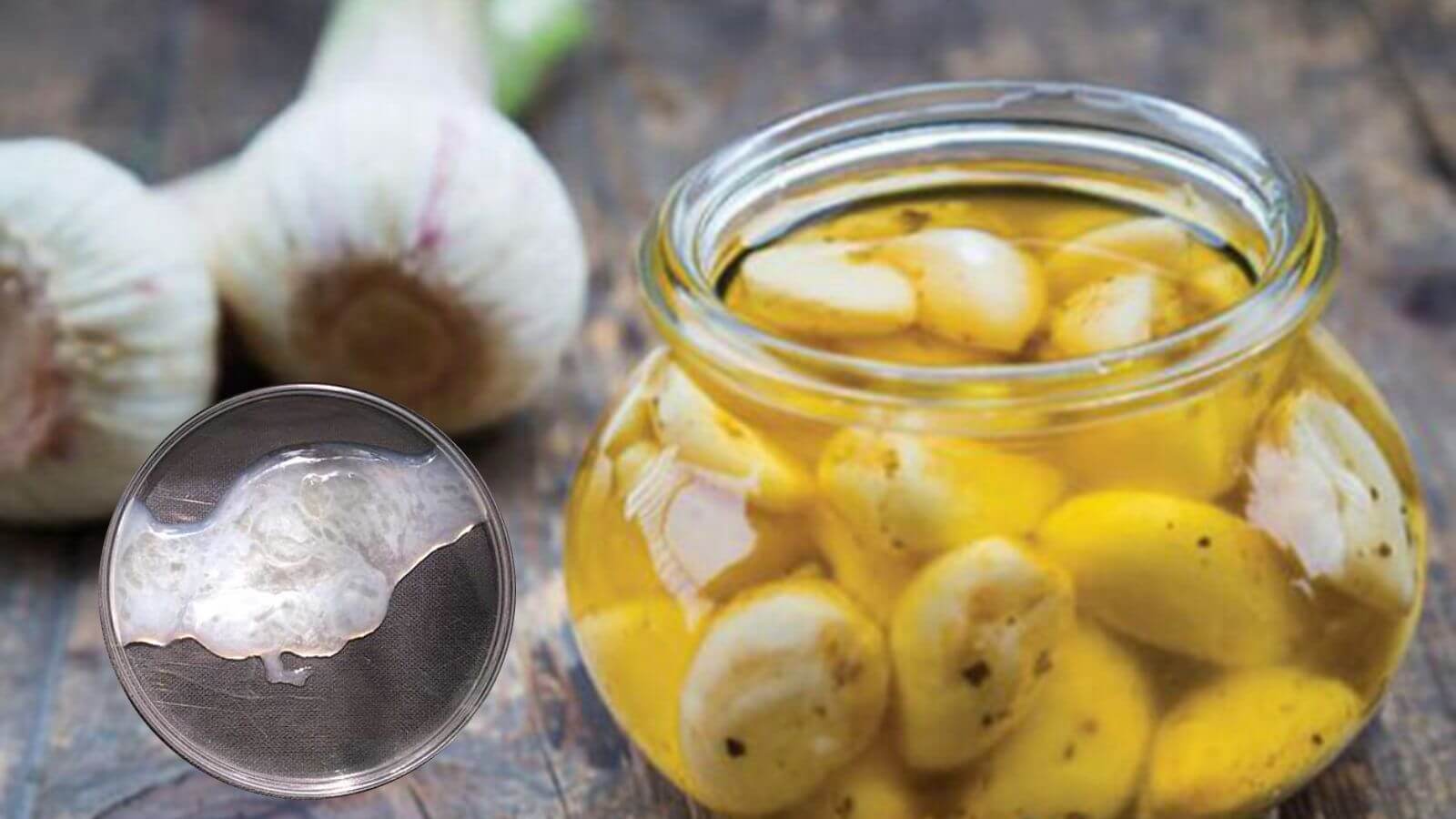 Sử dụng tỏi để chữa tinh trùng vón cục như thạch