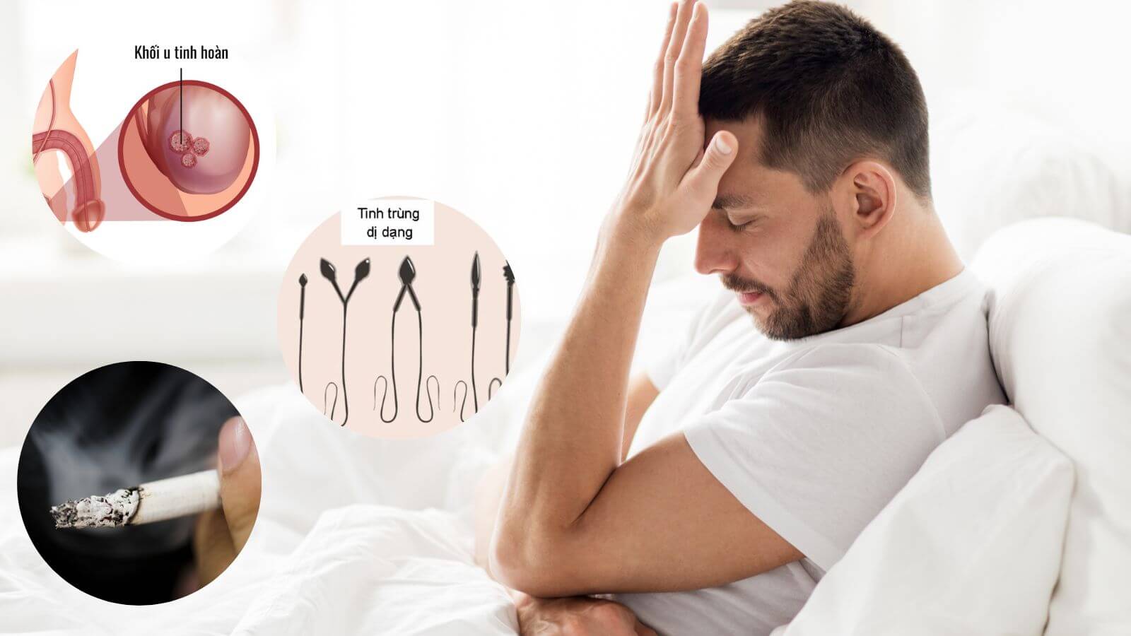 Có nhiều nguyên nhân khiến nam giới vô sinh