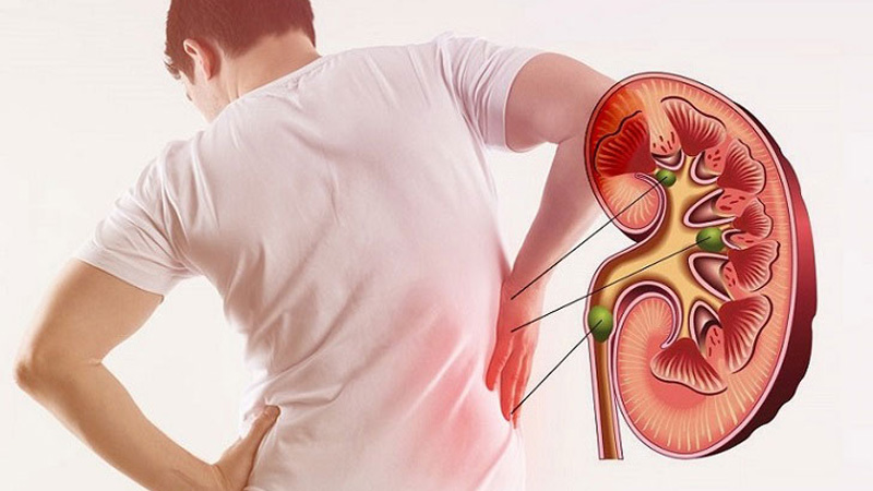 người tiểu đường giai đoạn cuối