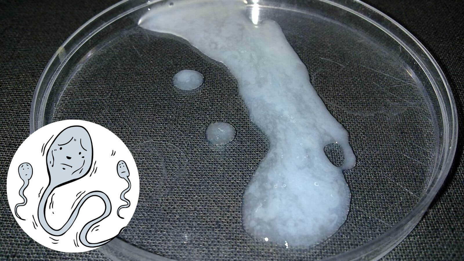 Đàn ông cần lưu ý một vài đặc điểm để có thể nhận biết tinh trùng yếu