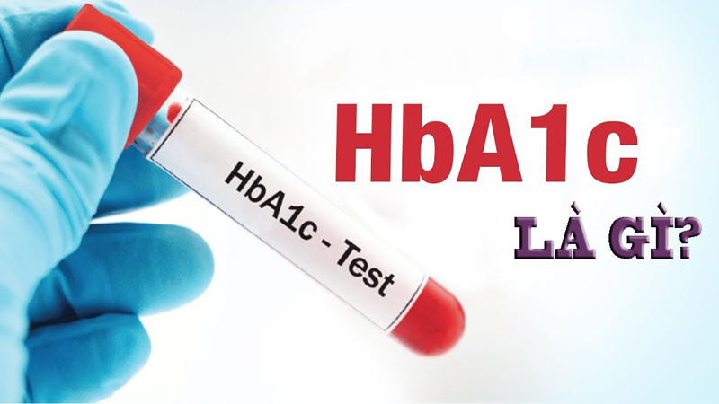 Chỉ số HbA1c là gì và ý nghĩa khi xét nghiệm