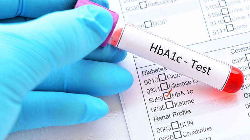 Lấy máu xét nghiệm HbA1c