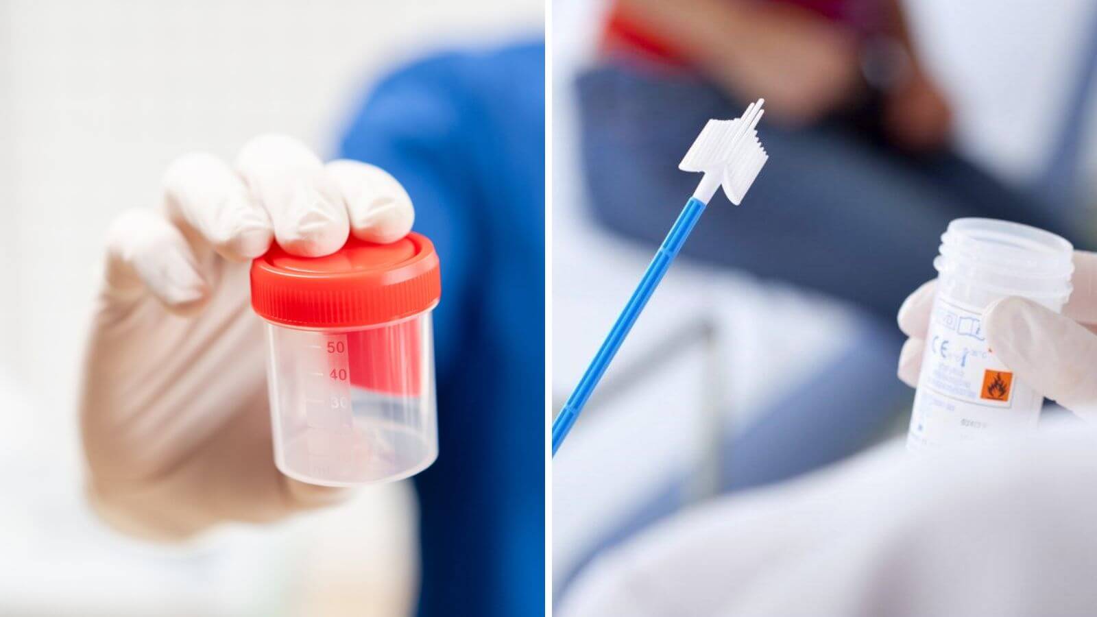 Hướng dẫn đọc kết quả tinh dịch đồ qua các chỉ số