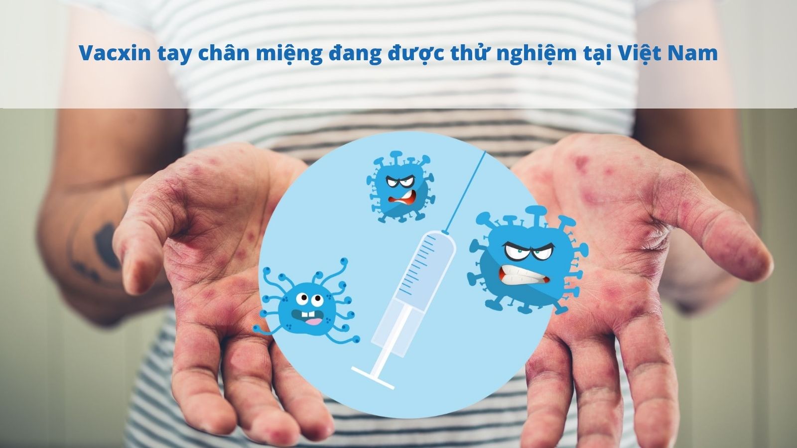 Vacxin ngừa tay chân miệng đang được thử nghiệm ở Việt Nam