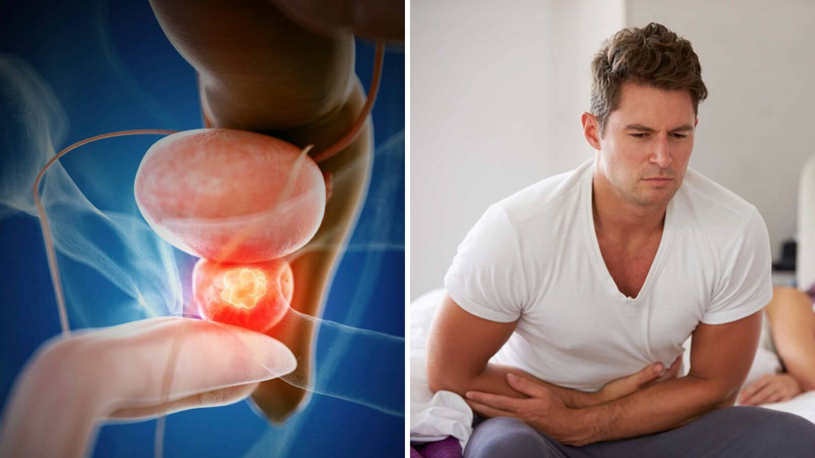 Viêm tuyến tiền liệt là tình trạng hay xảy ra ở nam giới trung niên