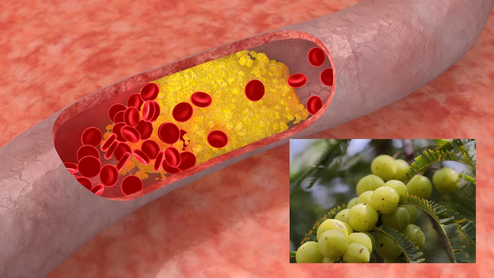 Me rừng còn có tác dụng giảm cholesterone, phòng ngừa xơ vữa động mạch