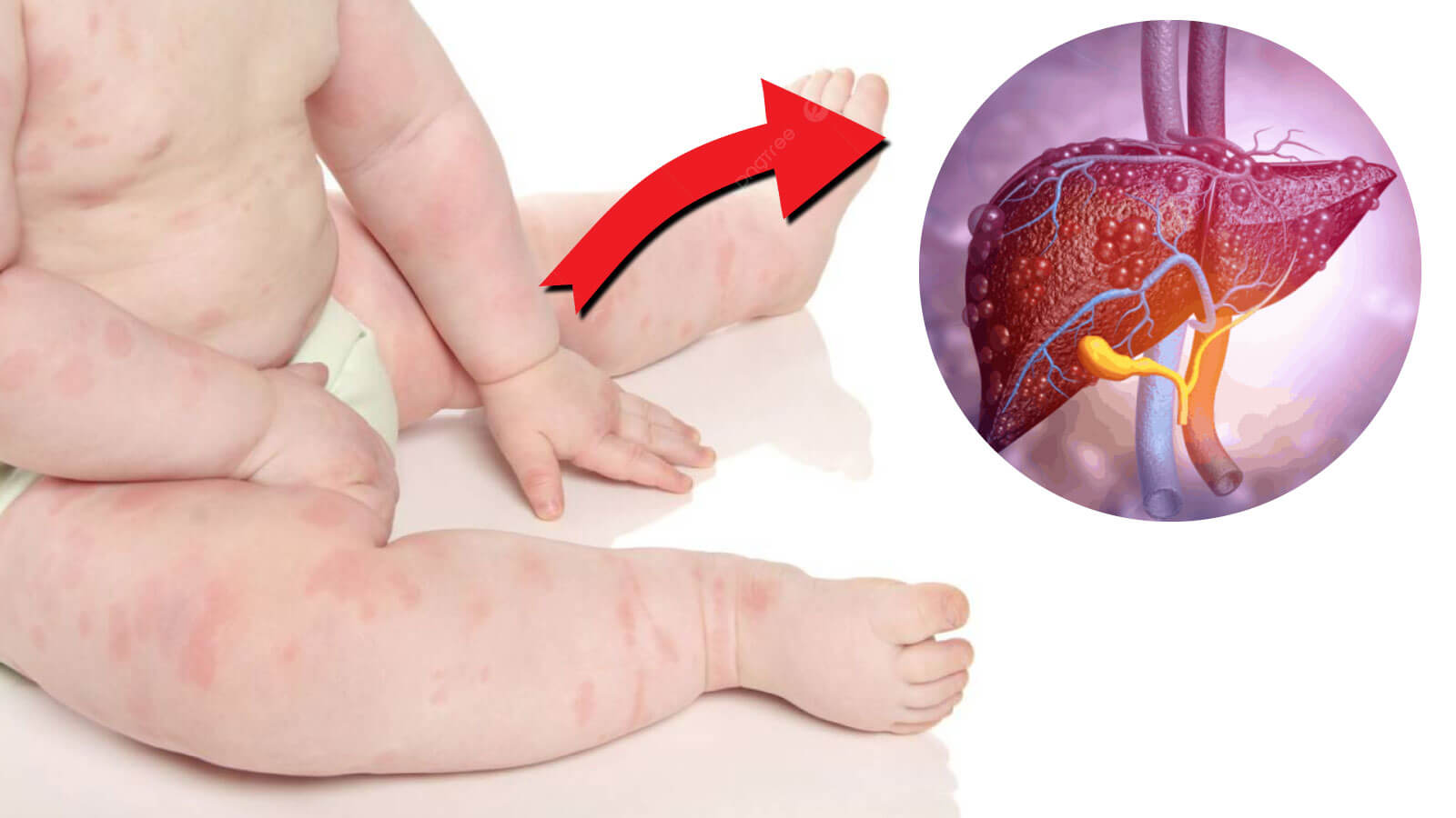 Tre Can Thai Doc Gan Khi Nao