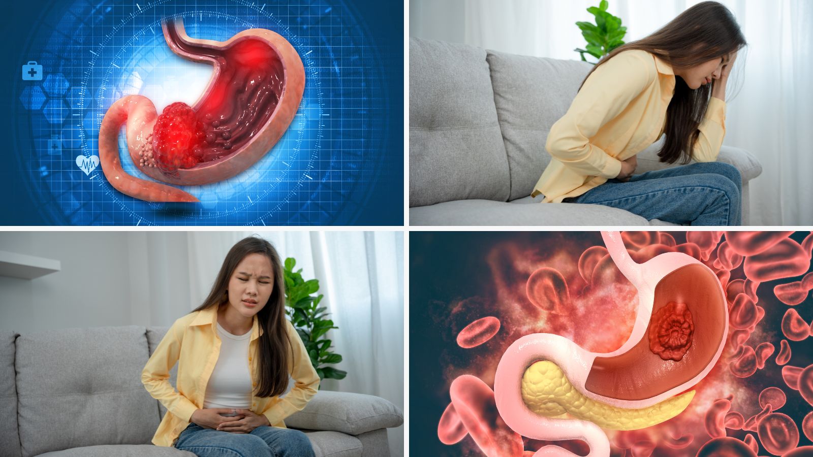 Bổ sung canxi không đúng thời điểm dễ gây đau dạ dày