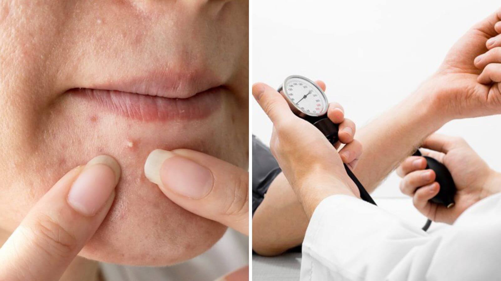 Các dấu hiệu testosterone cao thường gặp ở nam giới