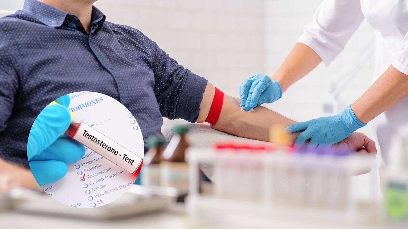 Xét nghiệm máu để biết rõ nồng độ testosterone trong cơ thể