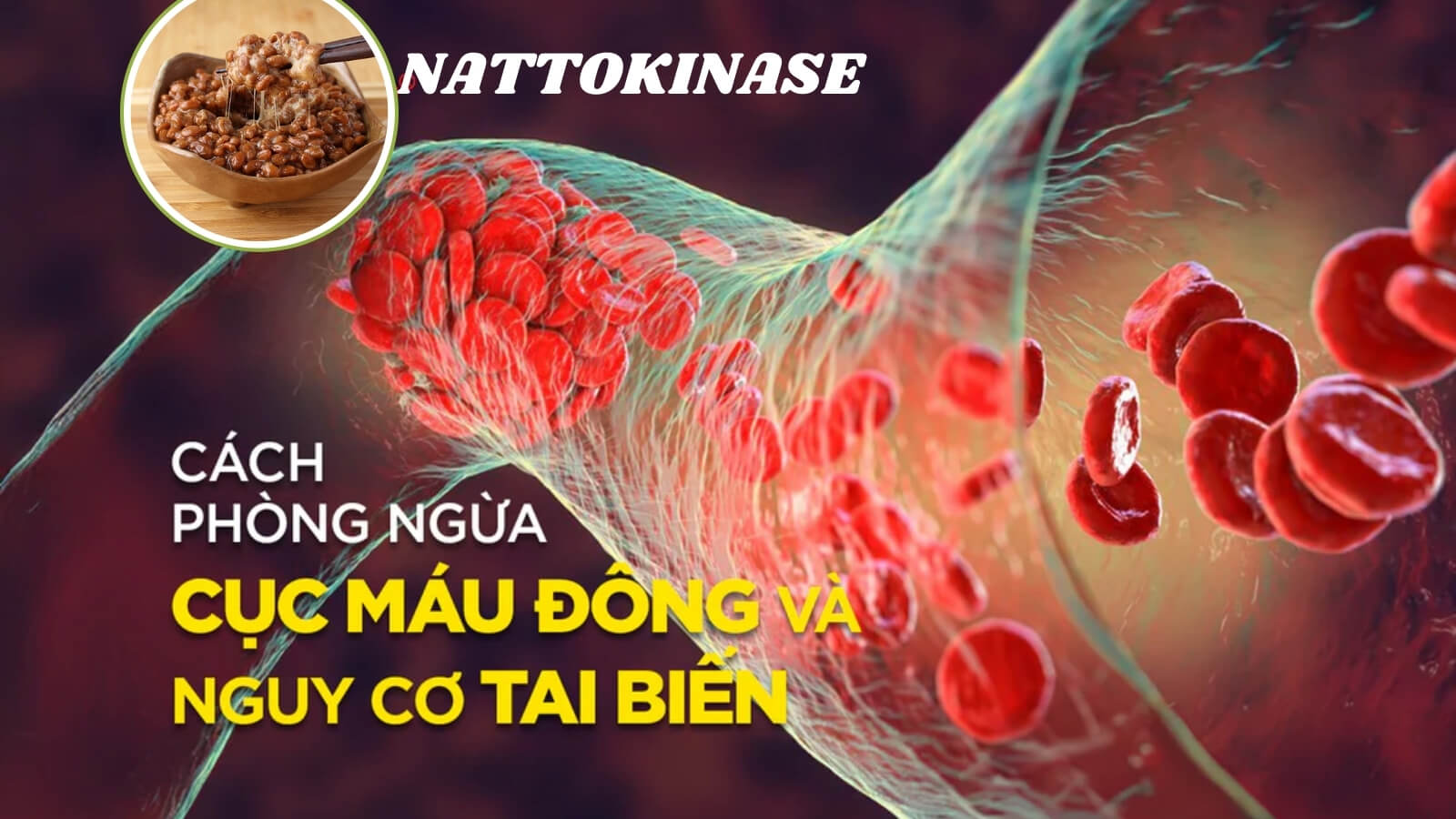 Nattokinase có vai trò trong việc ngăn ngừa hình thành cục máu đông