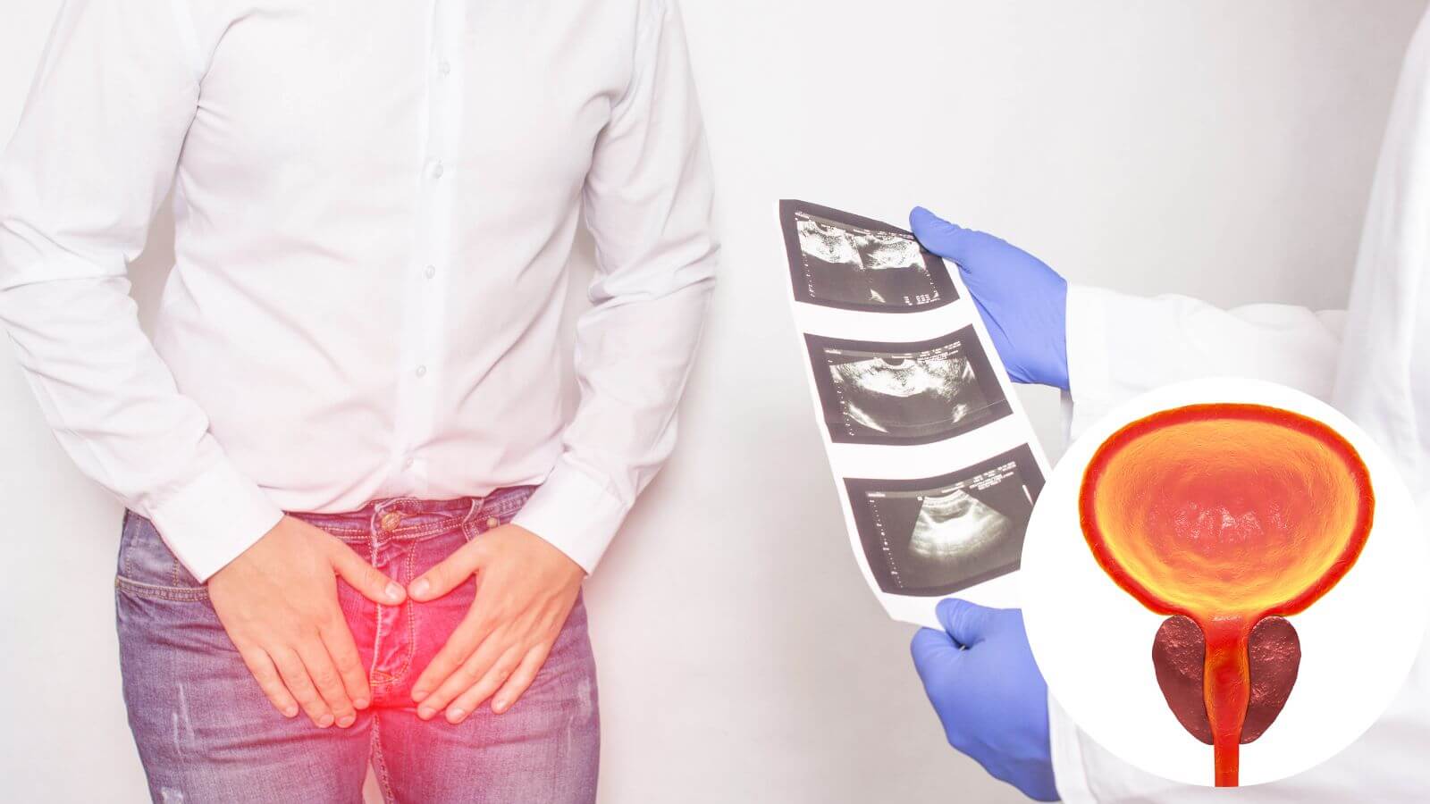 Nam giới có thể dùng các cây thuốc nam chữa viêm tuyến tiền liệt