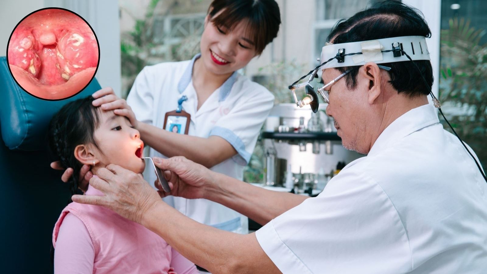 Bác sĩ kiểm tra họng để chẩn đoán viêm họng hạt