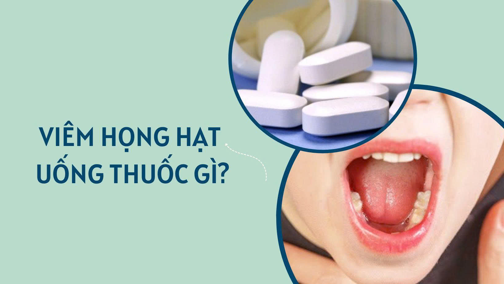 Viêm họng hạt uống thuốc gì? 4 nhóm thuốc thường dùng và lưu ý an toàn