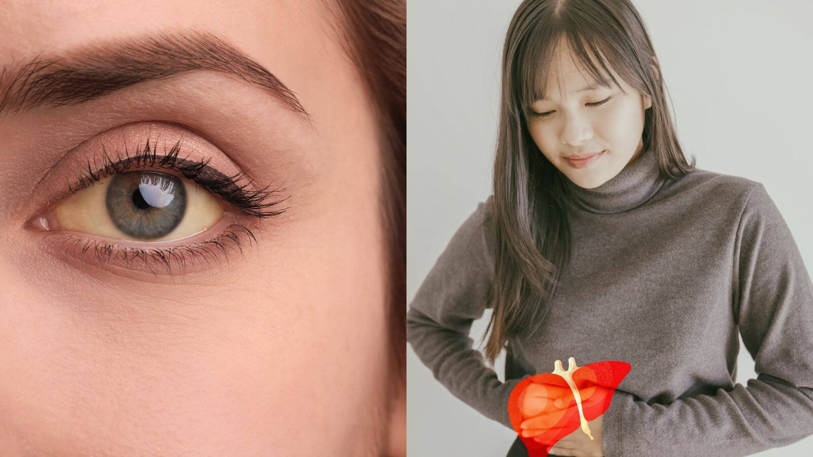 Một số dấu hiệu cảnh báo mắc bệnh về gan