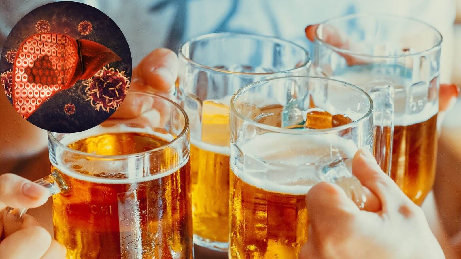 Uống rượu bia nhiều gây suy giảm chức năng gan