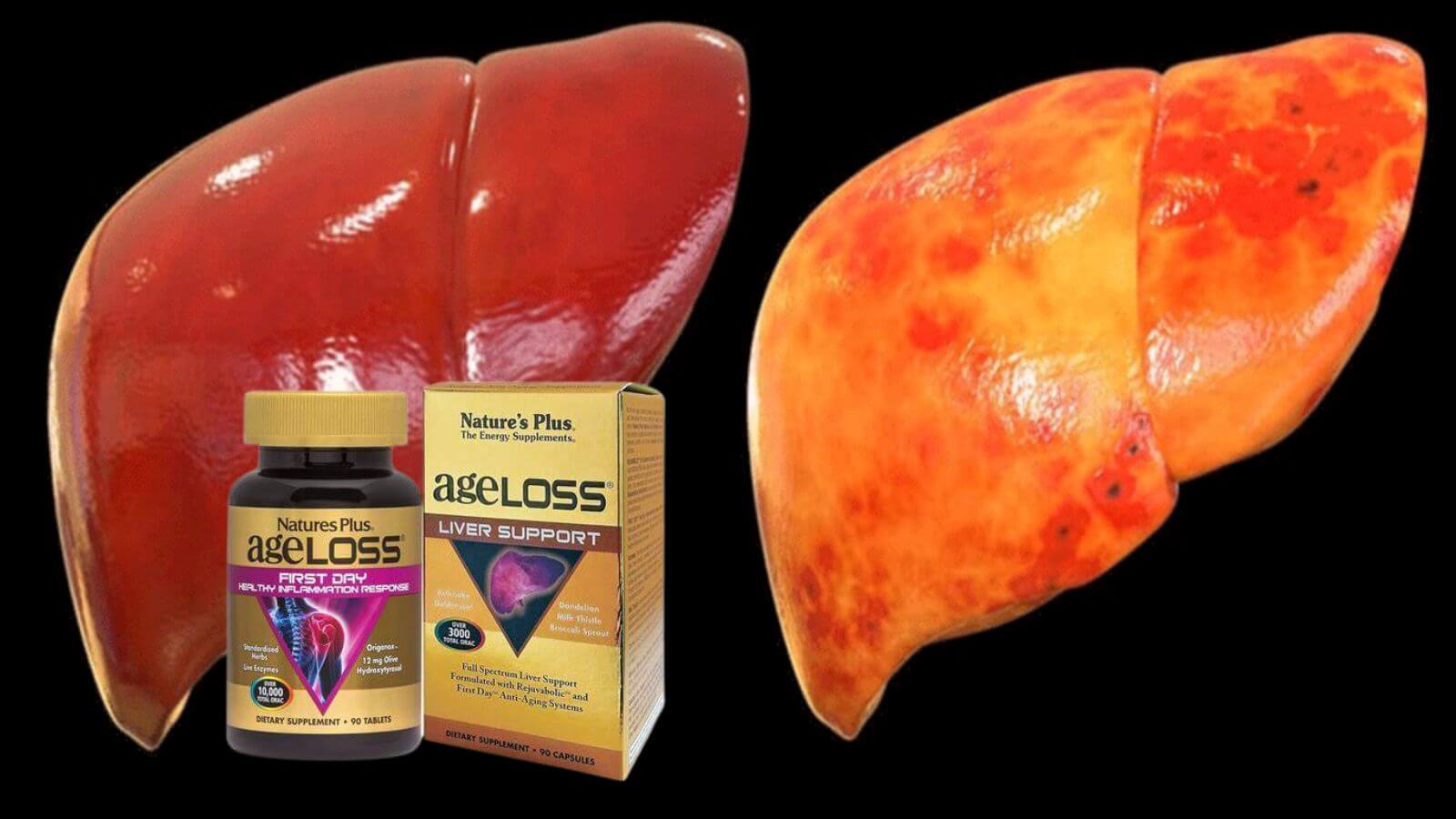 Ageloss Liver Support - Ngăn ngừa suy gan & phục hồi chức năng gan