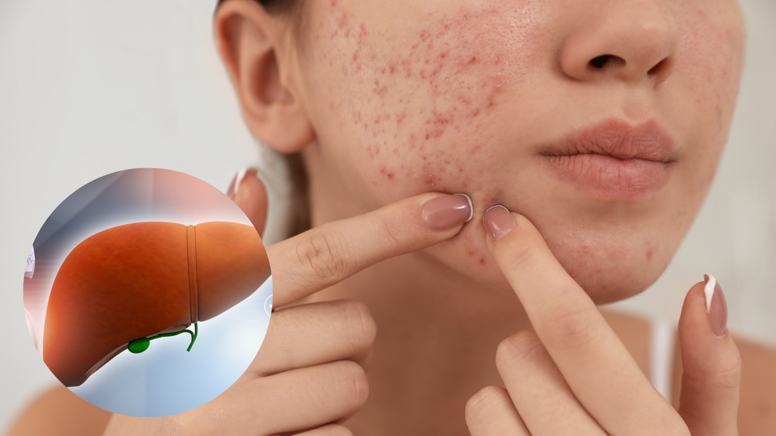 Các thành phần có trong bột Livecool giúp thanh nhiệt, giải độc gan hiệu quả