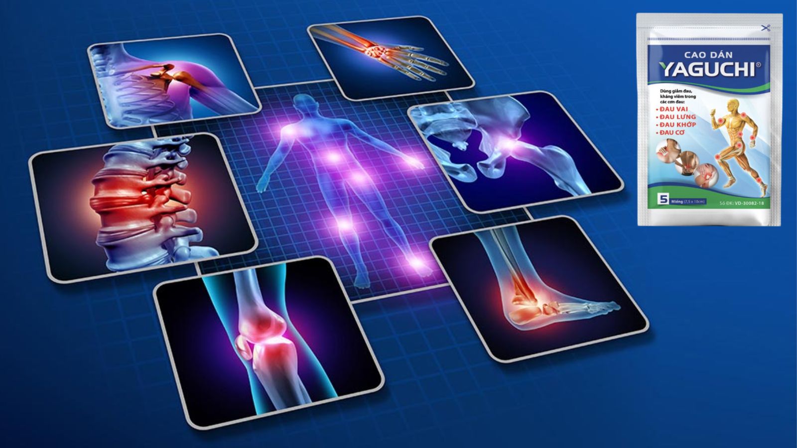 Cao dán Yaguchi - Hỗ trợ giảm đau chống viêm