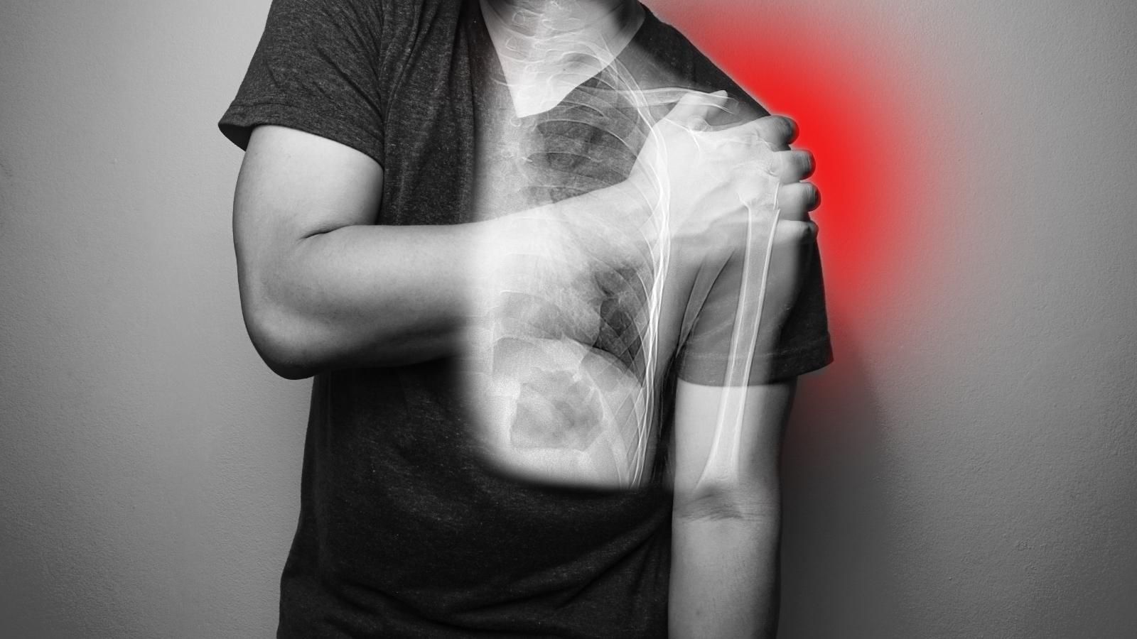 Các cơn đau vai gáy gây ra cảm giác khó chịu cho người mắc phải