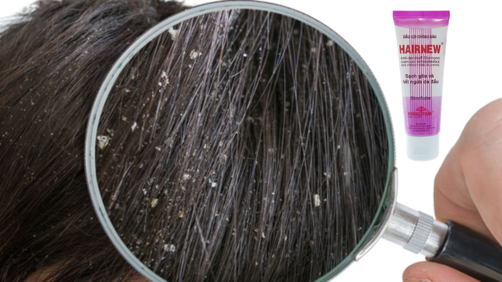 Hair new - Dầu gội chống gàu