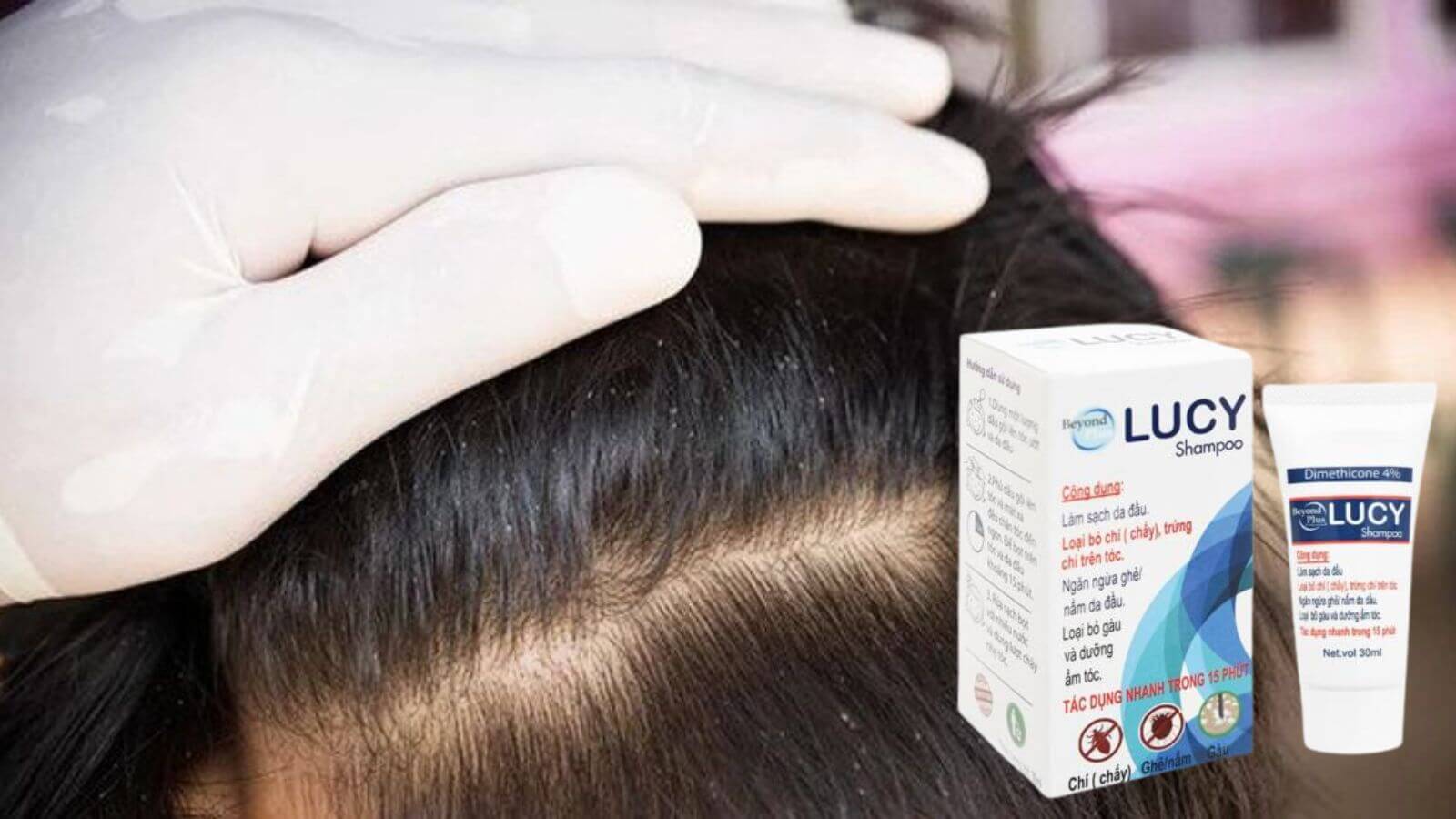 Dầu gội Lucy trị chấy giúp làm sạch da đầu, loại bỏ chí (chấy), trứng chí trên tóc